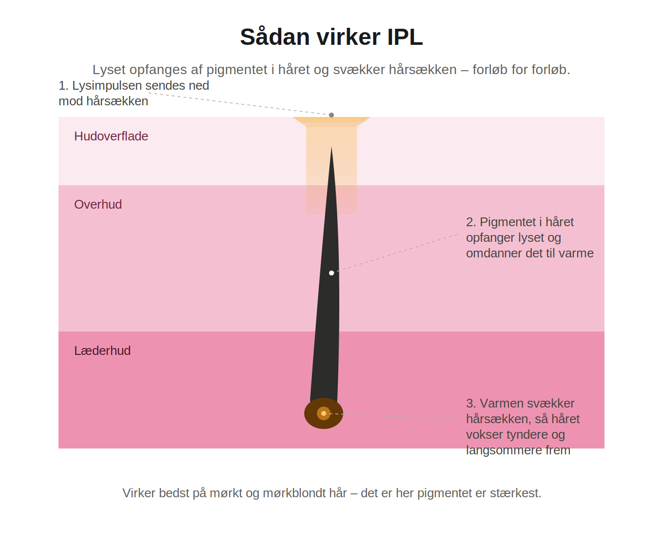 Aveline Lumi – IPL hårfjerner for kropp og ansikt